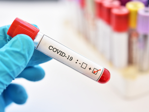 4 νέα κρούσματα COVID-19 ανακοίνωσε ο ΕΟΔΥ στην ΠΕ Κω, σήμερα Σάββατο 13 Μαρτίου