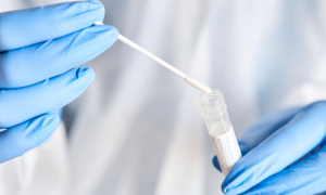 Αρνητικά τα test για COVID-19 που πραγματοποίησαν κλιμάκια του ΕΟΔΥ σε Ζηπάρι και Κέφαλο, το Σάββατο &amp; την Κυριακή