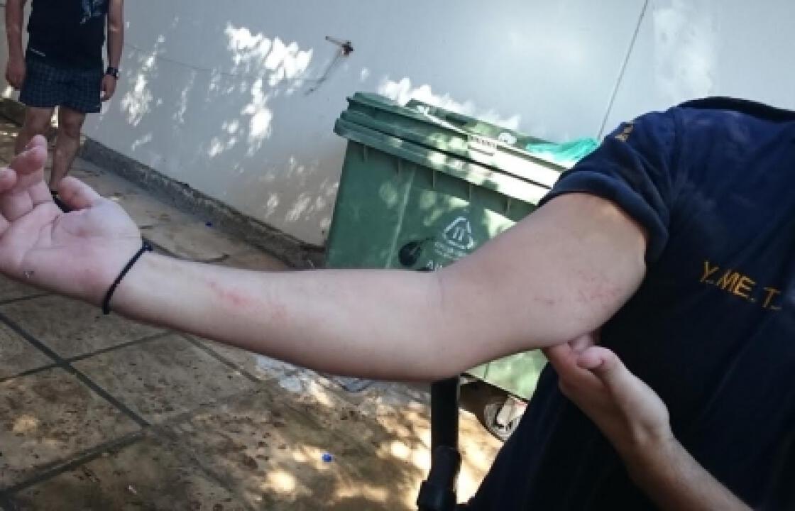 Δέχθηκε επίθεση και η διμοιρία της ΥΜΕΤ στην Κώ.Τραυματισμός αστυνομικού.ΦΩΤΟ