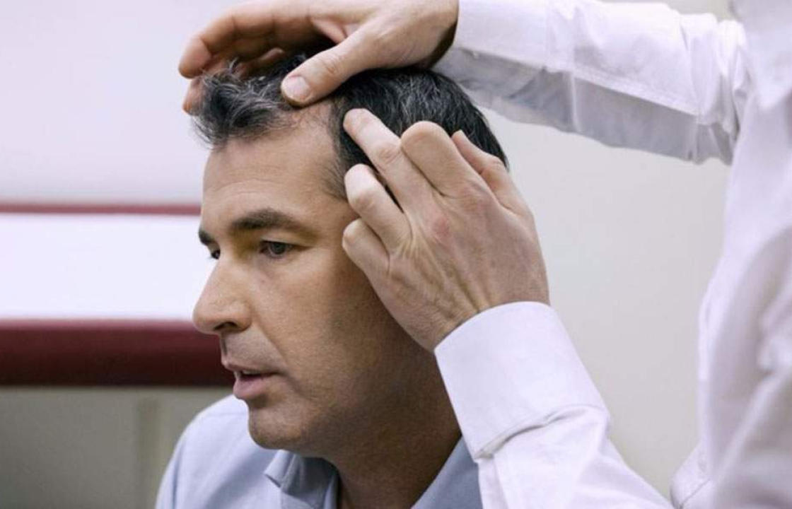 Οι δερματολόγοι παγκοσμίως προειδοποιούν: Μην κάνετε μεταμοσχεύσεις μαλλιών στην Τουρκία