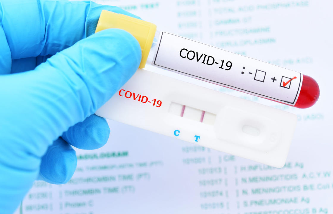 4νέα κρούσματα COVID-19 ανακοίνωσε ο ΕΟΔΥ στην ΠΕ Κω, σήμερα Δευτέρα 29 Μαρτίου
