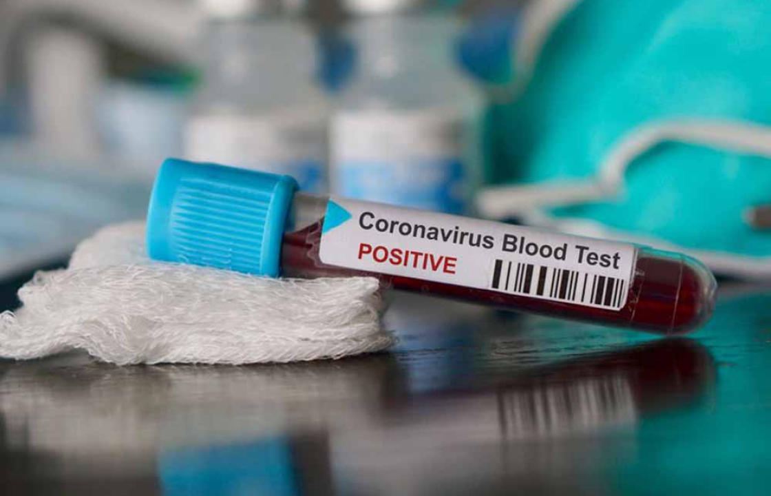 8 νέα κρούσματα COVID-19 ανακοίνωσε ο ΕΟΔΥ στην ΠΕ Κω, σήμερα Τετάρτη 21 Απριλίου