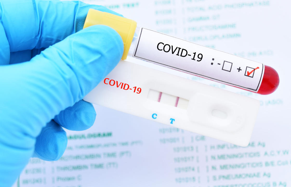 Η ημερήσια έκθεση επιτήρησης COVID-19 του ΕΟΔΥ για σήμερα  Κυριακή 27 Ιουνίου