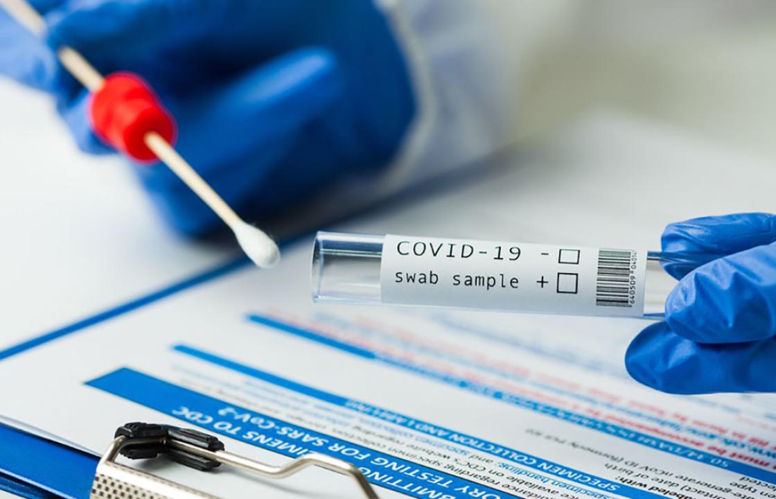 Η ημερήσια έκθεση επιτήρησης COVID-19 του ΕΟΔΥ για σήμερα Τετάρτη  25 Αυγούστου