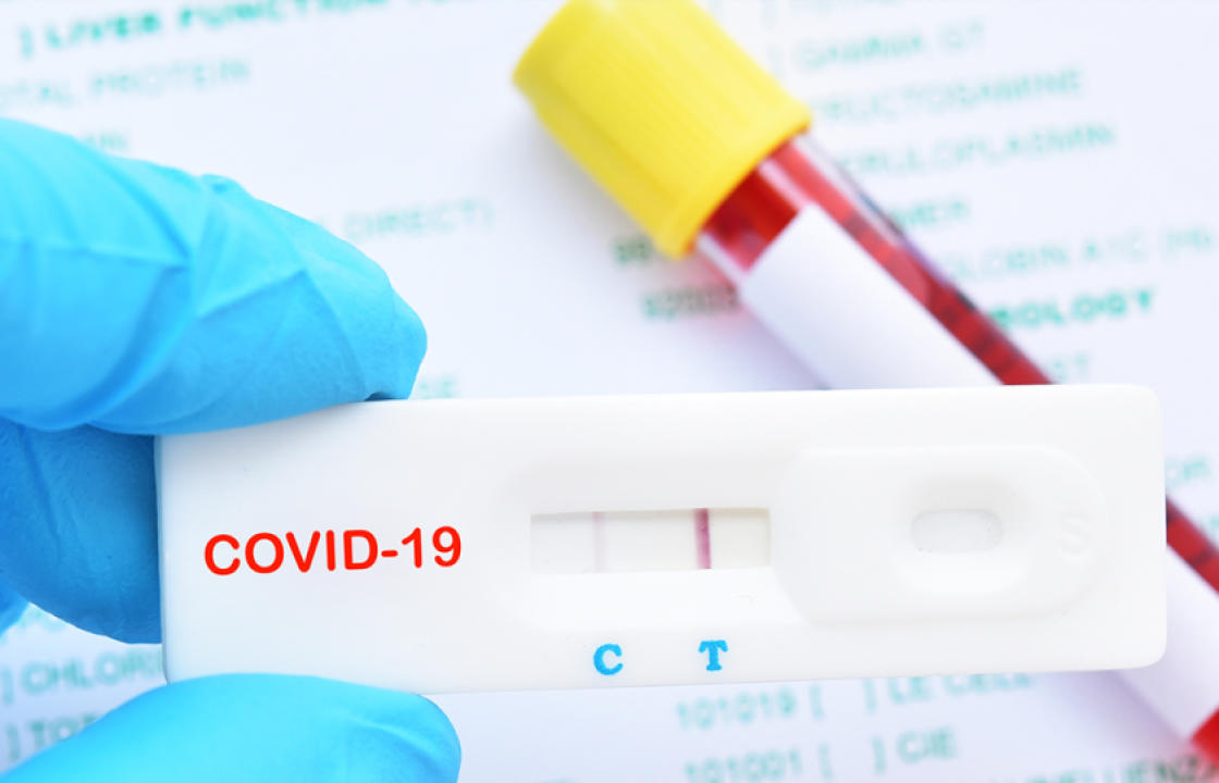 Η ημερήσια έκθεση επιτήρησης COVID-19 του ΕΟΔΥ για σήμερα Παρασκευή 17 Σεπτεμβρίου