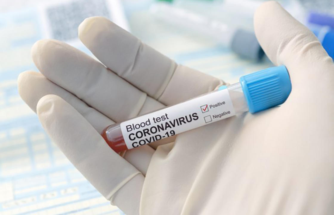 Η ημερήσια έκθεση επιτήρησης COVID-19 του ΕΟΔΥ για σήμερα Πέμπτη 30 Σεπτεμβρίου