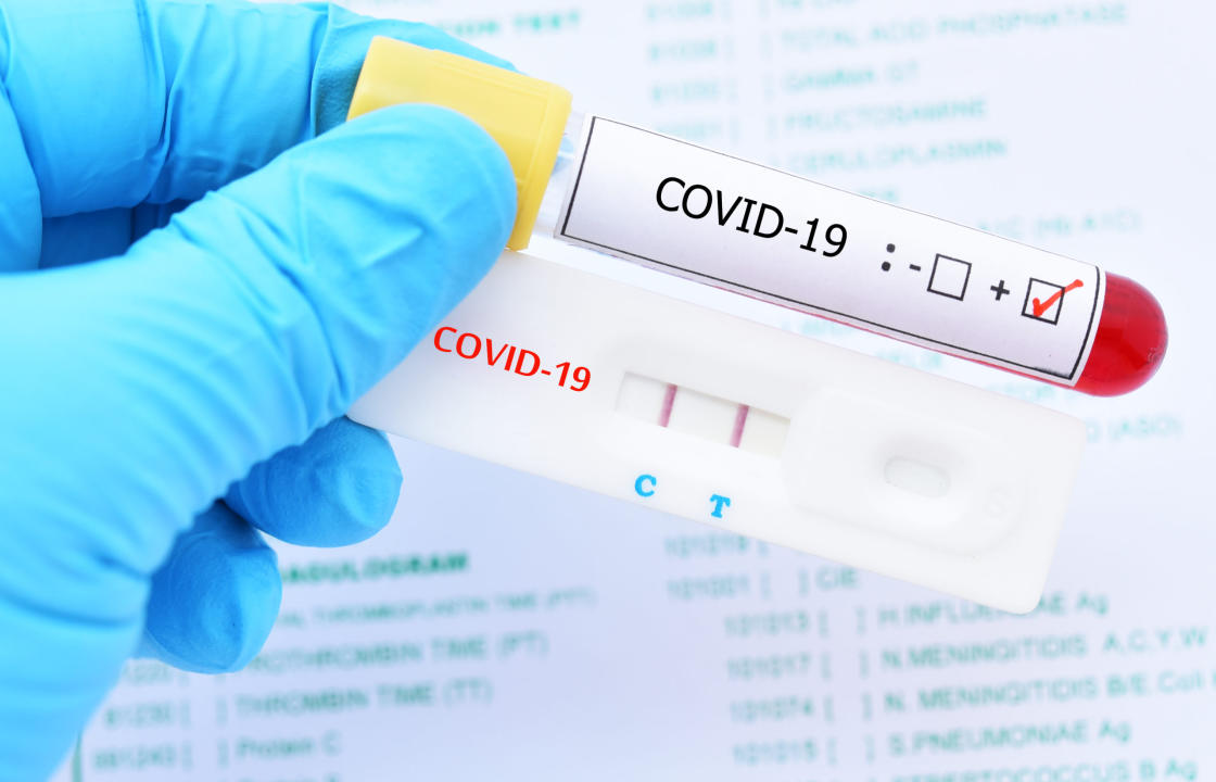 Η ημερήσια έκθεση επιτήρησης COVID-19 του ΕΟΔΥ για το Σάββατο 11 Δεκεμβρίου