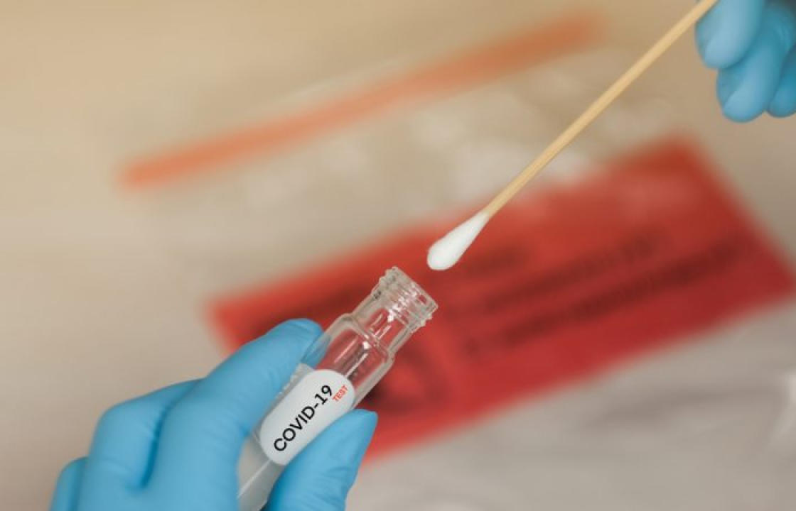 Η ημερήσια έκθεση επιτήρησης COVID-19 του ΕΟΔΥ για την Κυριακή 13 Φεβρουαρίου