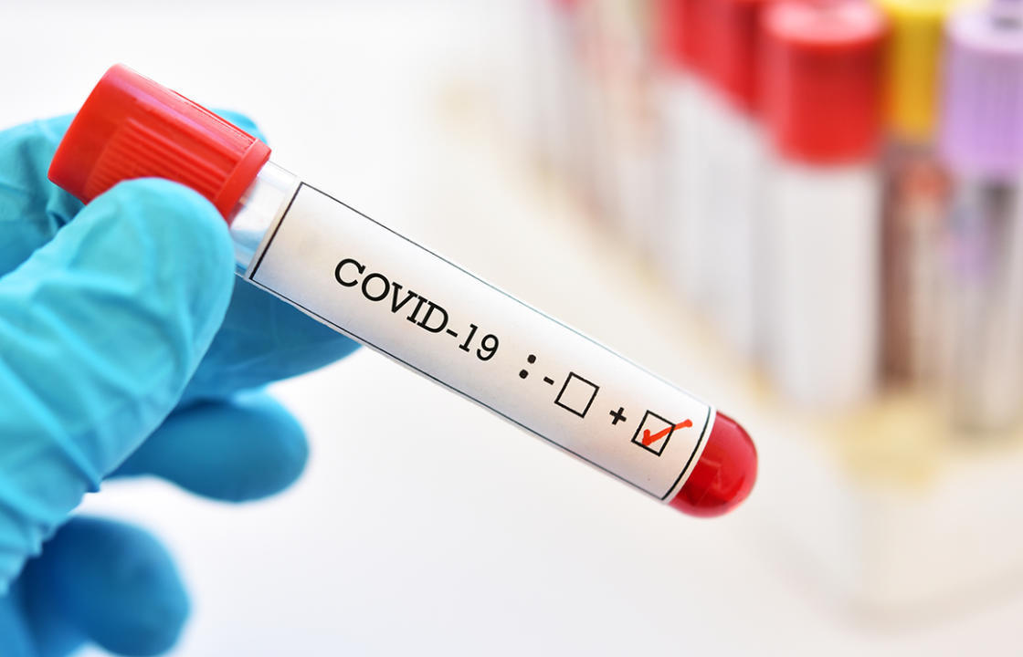 Η ημερήσια έκθεση επιτήρησης COVID-19 του ΕΟΔΥ για την Παρασκευή 11 Μαρτίου