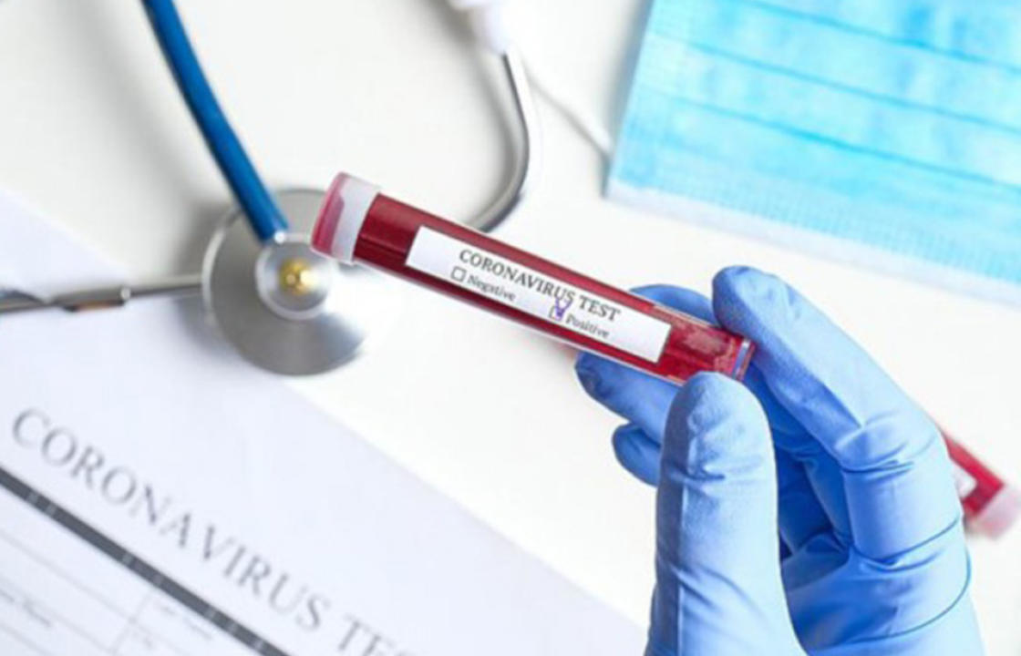 Η ημερήσια έκθεση επιτήρησης COVID-19 του ΕΟΔΥ για την Πέμπτη 17 Μαρτίου