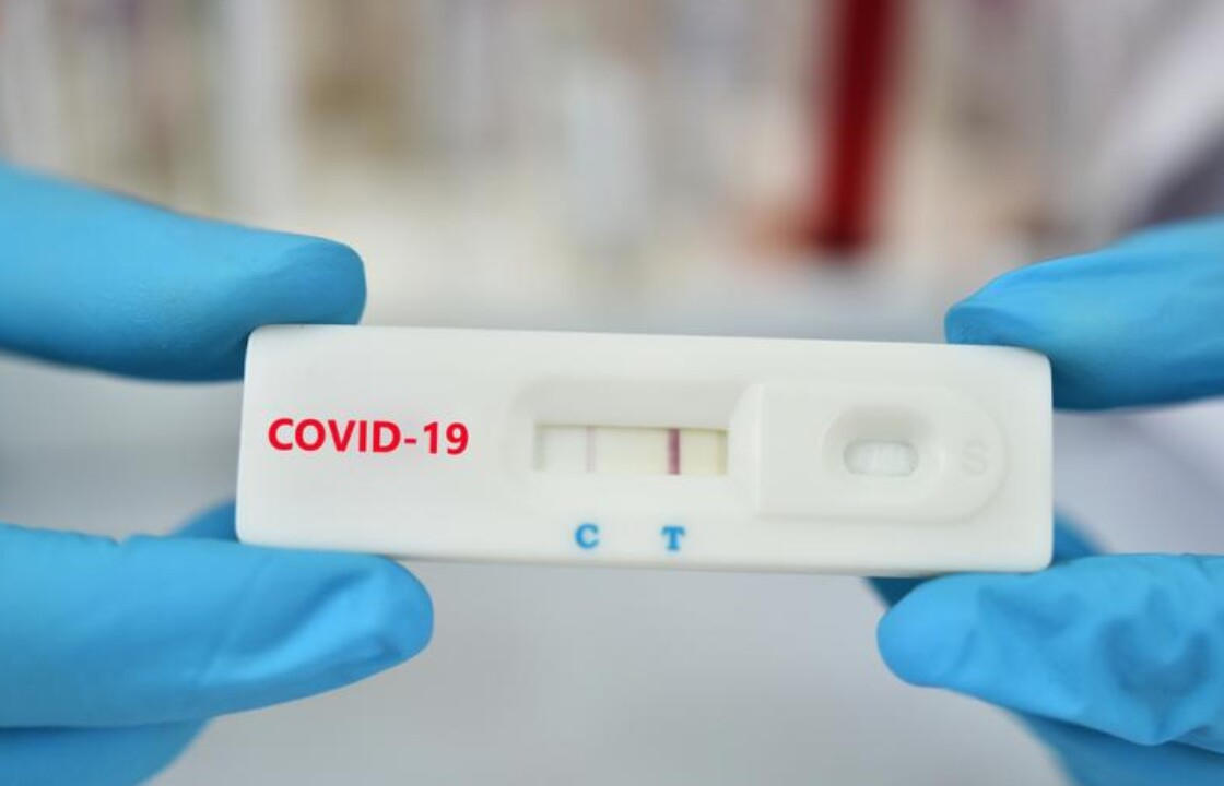 Η ημερήσια έκθεση επιτήρησης COVID-19 του ΕΟΔΥ για την Παρασκευή 25 Μαρτίου